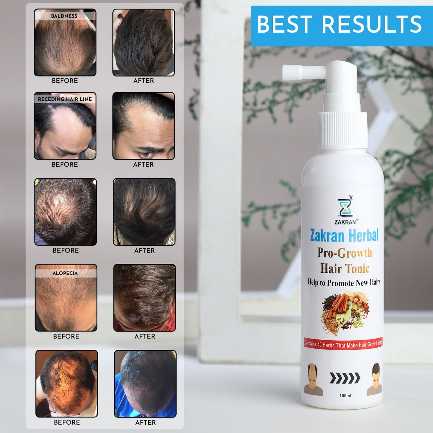 ZAKRAN Hair Growth Spray.