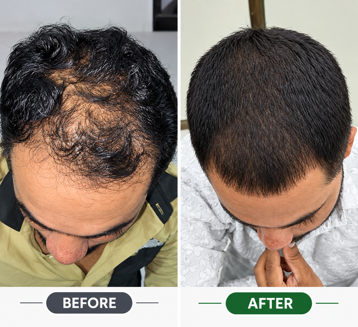 DR Hair Growth Serum